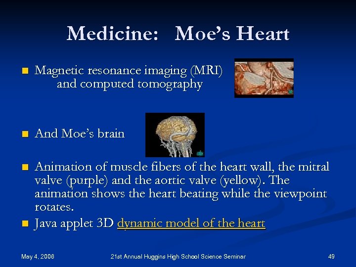Medicine: Moe’s Heart n Magnetic resonance imaging (MRI) and computed tomography n And Moe’s