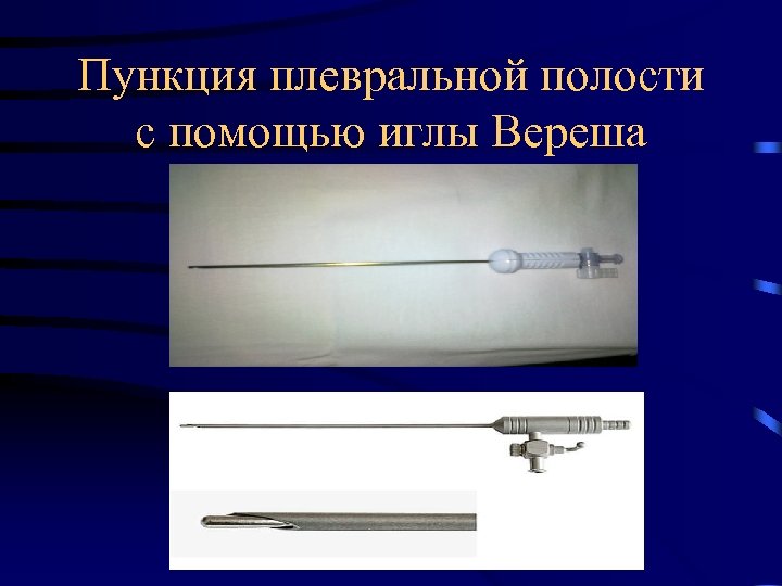 Пункция плевральной полости с помощью иглы Вереша 