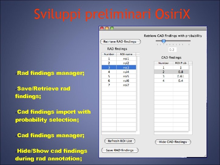 Sviluppi preliminari Osiri. X Rad findings manager; Save/Retrieve rad findings; Cad findings import with