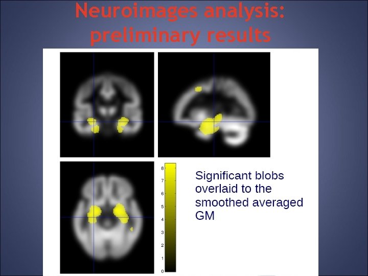 Neuroimages analysis: preliminary results 