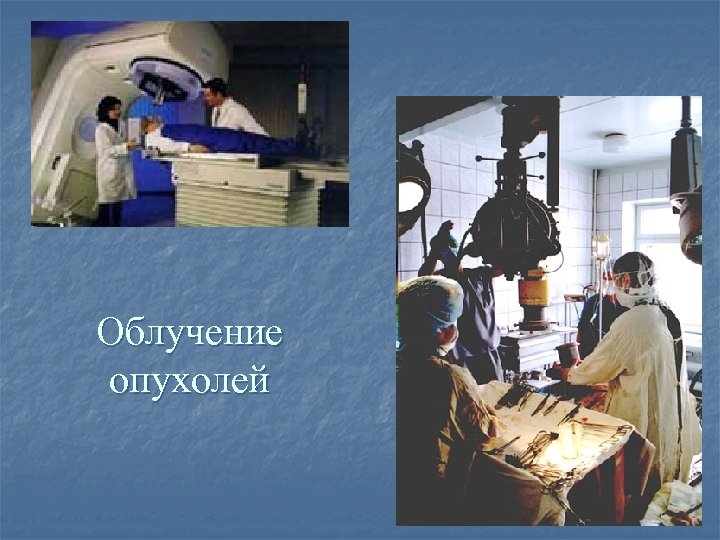 Облучение опухолей 