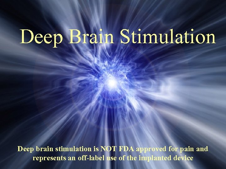 Deep Brain Stimulation Deep brain stimulation is NOT FDA approved for pain and represents