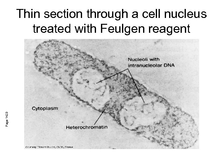 Page 1423 Thin section through a cell nucleus treated with Feulgen reagent 