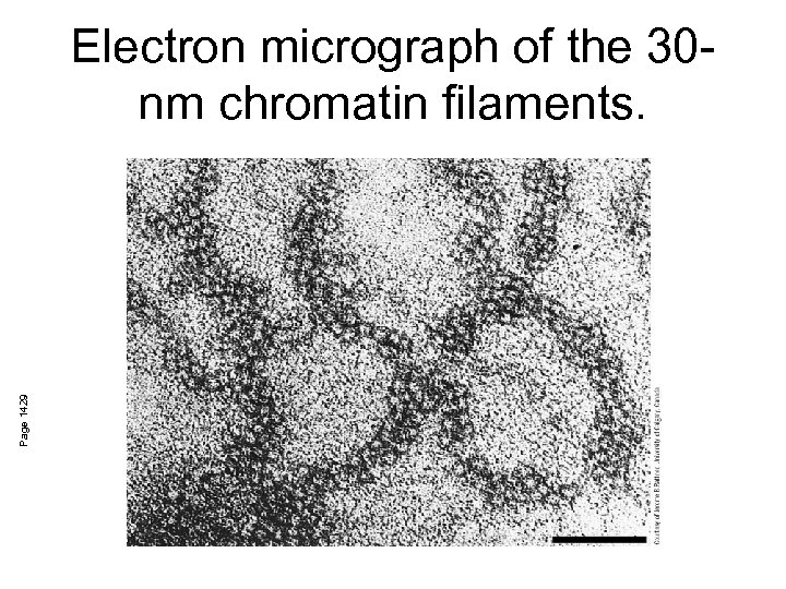 Page 1429 Electron micrograph of the 30 nm chromatin filaments. 