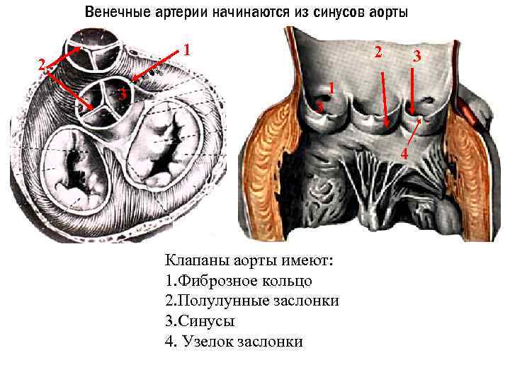 Венечные артерии начинаются из синусов аорты 1 2 3 1 3 4 Клапаны аорты