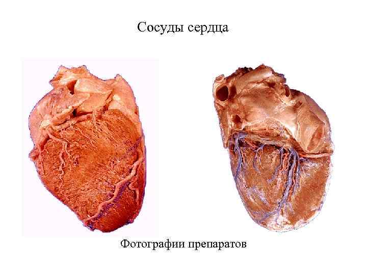 Сосуды сердца Фотографии препаратов 