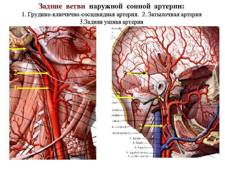 Воспаление грудино ключично сосцевидной мышцы фото