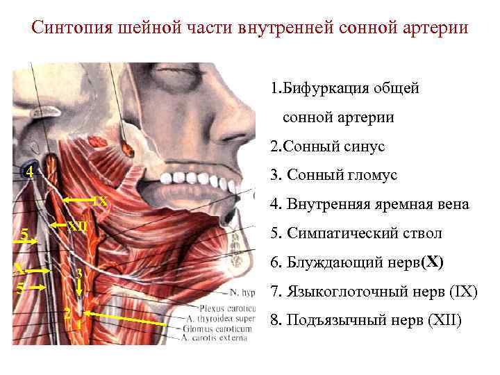 Синтопия шейной части внутренней сонной артерии 1. Бифуркация общей сонной артерии 2. Сонный синус