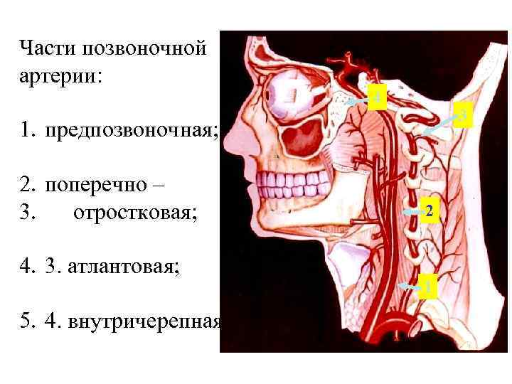 Асимметрия правой позвоночной артерии