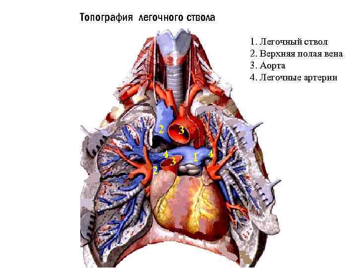 Легочный ствол картинка