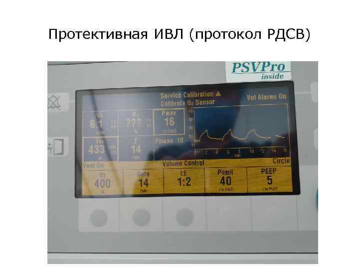 Протективная ИВЛ (протокол РДСВ) 
