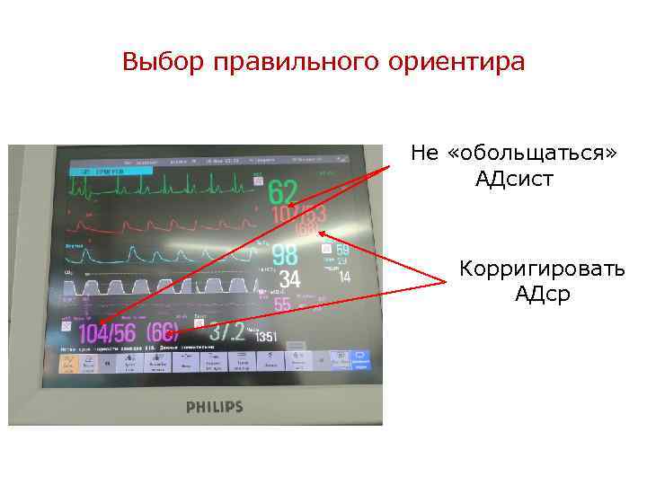 Выбор правильного ориентира Не «обольщаться» АДсист Корригировать АДср 