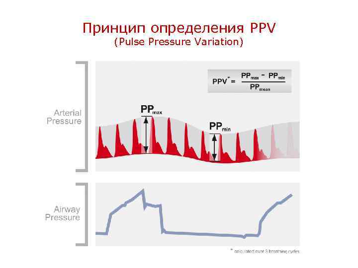 Принцип определения PPV (Pulse Pressure Variation) 