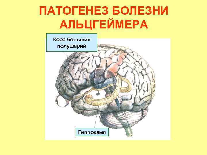 ПАТОГЕНЕЗ БОЛЕЗНИ АЛЬЦГЕЙМЕРА Кора больших полушарий Гиппокамп 
