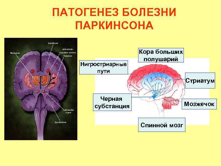 Презентация болезнь паркинсона неврология