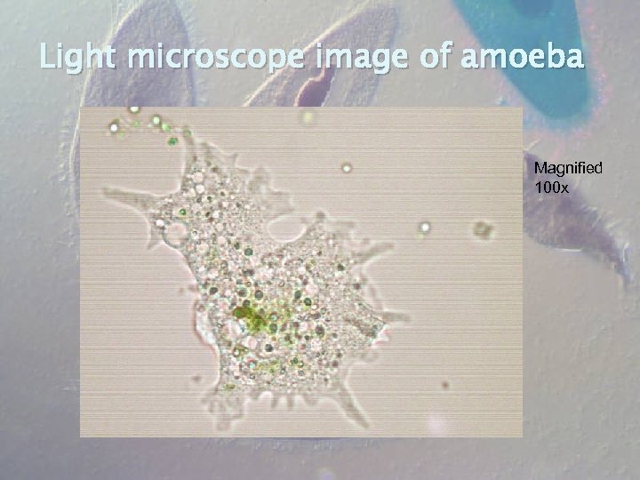 Light microscope image of amoeba Magnified 100 x 