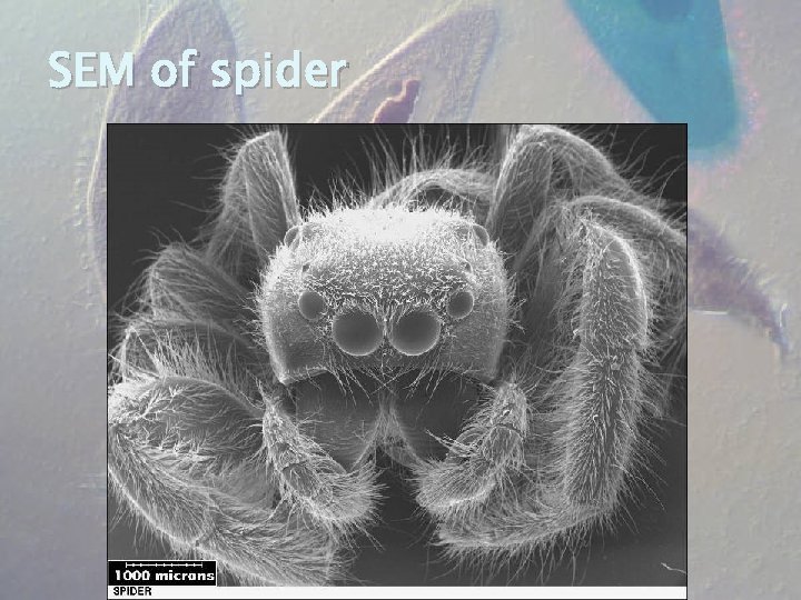 SEM of spider 