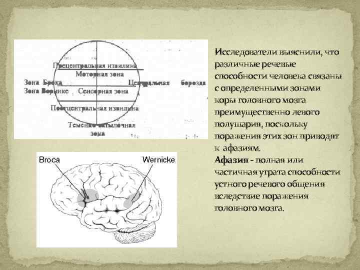 Исследователи выяснили, что различные речевые способности человека связаны с определенными зонами коры головного мозга