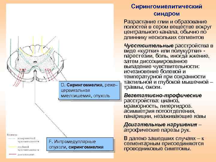 Половинное поражение спинного мозга