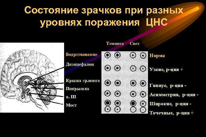 Состояние зрачков при разных уровнях поражения ЦНС Темнота Бодрствование Диэнцефалон Крыша ср. мозга Покрышка