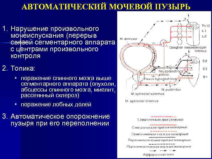 АВТОМАТИЧЕСКИЙ МОЧЕВОЙ ПУЗЫРЬ 1. Нарушение произвольного мочеиспускания (перерыв связей сегментарного аппарата с центрами произвольного