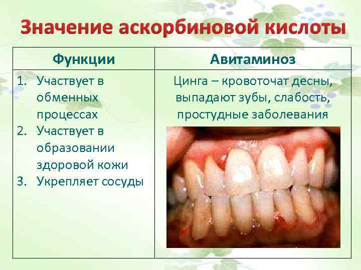 Значение аскорбиновой кислоты Функции Авитаминоз 1. Участвует в обменных процессах 2. Участвует в образовании