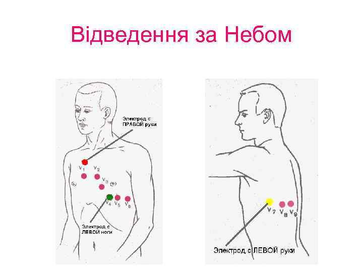 Відведення за Небом 