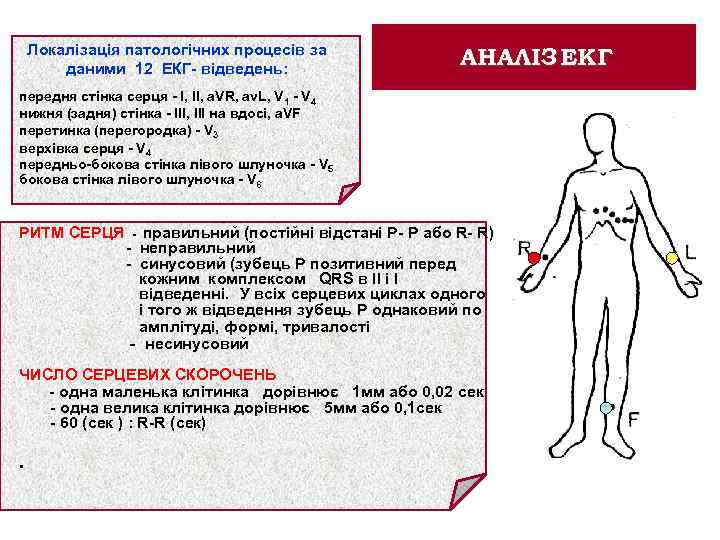 Локалізація патологiчних процесiв за даними 12 ЕКГ- вiдведень: АНАЛІЗ ЕКГ передня стiнка серця -