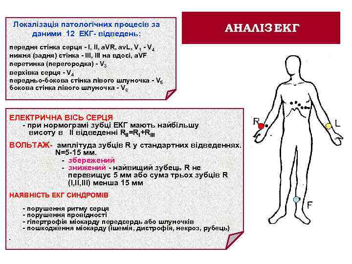 Локалізація патологiчних процесiв за даними 12 ЕКГ- вiдведень: АНАЛІЗ ЕКГ передня стiнка серця -