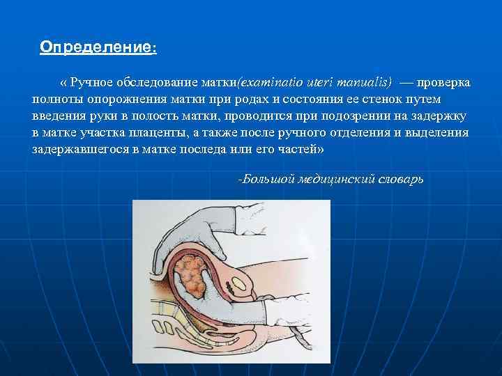  Определение: « Ручное обследование матки(examinatio uteri manualis) — проверка полноты опорожнения матки при