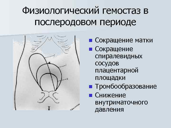 Физиологический гемостаз в послеродовом периоде n n Сокращение матки Сокращение спиралевидных сосудов плацентарной площадки