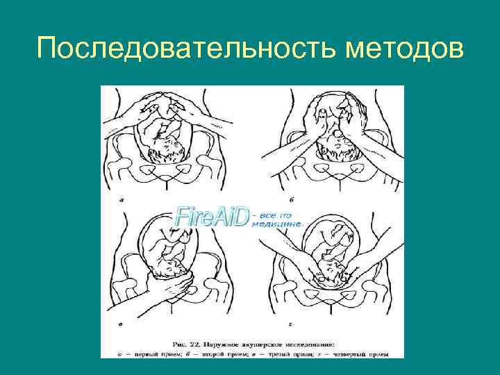 Последовательность методов 