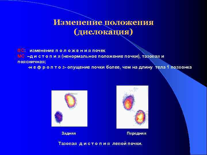 Изменение положения (дислокация) ВС: изменение п о л о ж е н и я