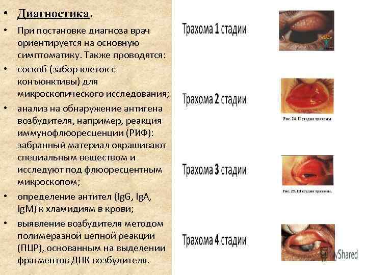  • Диагностика. • При постановке диагноза врач ориентируется на основную симптоматику. Также проводятся: