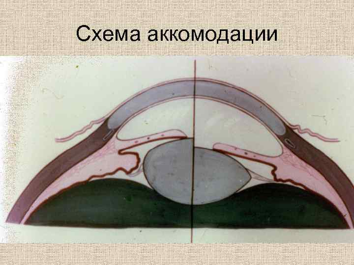 Схема аккомодации 