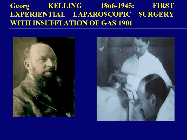 Georg KELLING 1866 -1945: FIRST EXPERIENTIAL LAPAROSCOPIC SURGERY WITH INSUFFLATION OF GAS 1901 