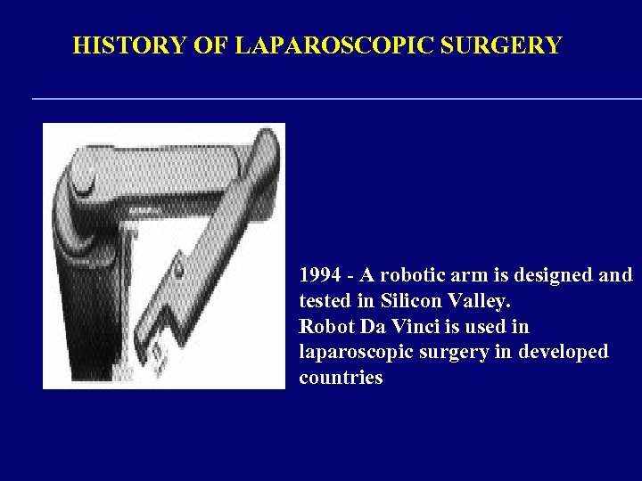 HISTORY OF LAPAROSCOPIC SURGERY 1994 - A robotic arm is designed and tested in