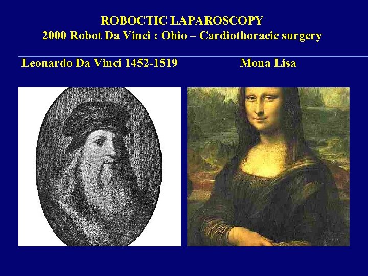 ROBOCTIC LAPAROSCOPY 2000 Robot Da Vinci : Ohio – Cardiothoracic surgery Leonardo Da Vinci