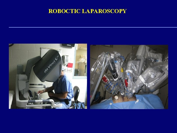 ROBOCTIC LAPAROSCOPY 