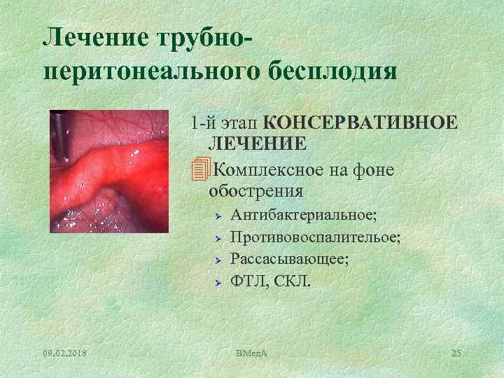 Лечение трубноперитонеального бесплодия 1 й этап КОНСЕРВАТИВНОЕ ЛЕЧЕНИЕ 4 Комплексное на фоне обострения Ø