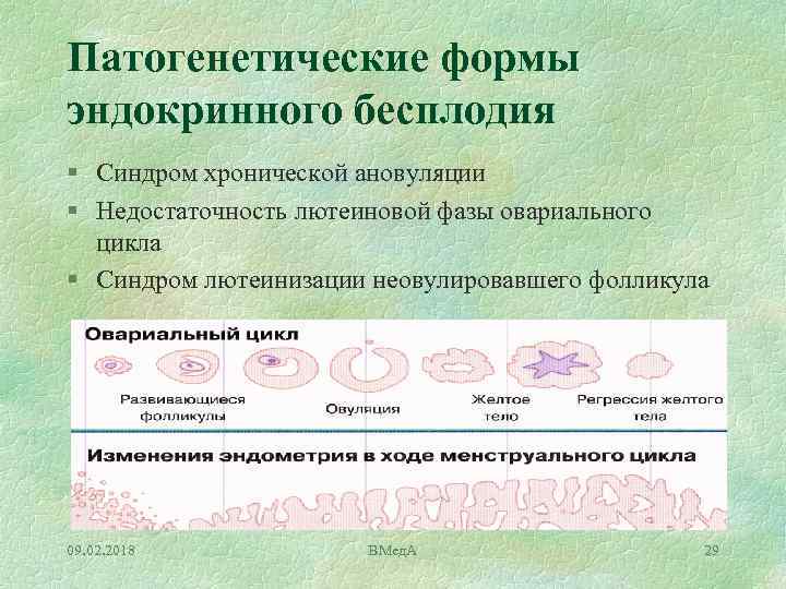 Патогенетические формы эндокринного бесплодия § Синдром хронической ановуляции § Недостаточность лютеиновой фазы овариального цикла