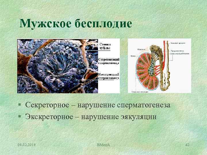 Мужское бесплодие § Секреторное – нарушение сперматогенеза § Экскреторное – нарушение эякуляции 09. 02.