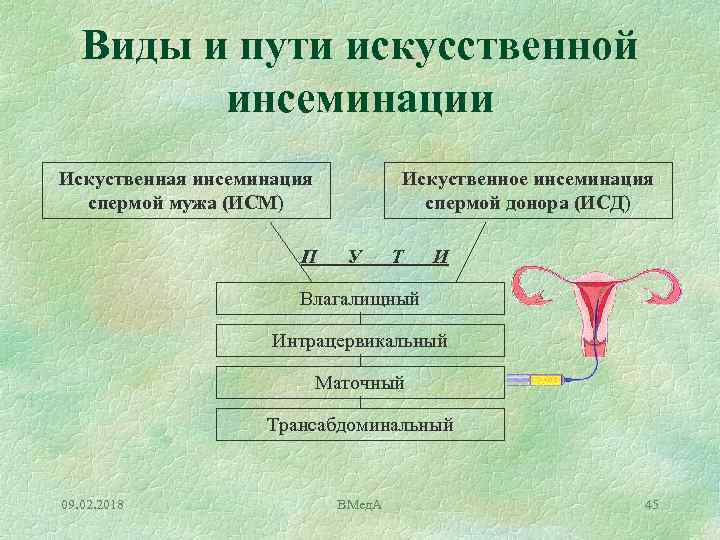 Виды и пути искусственной инсеминации Искуственная инсеминация спермой мужа (ИСМ) Искуственное инсеминация спермой донора