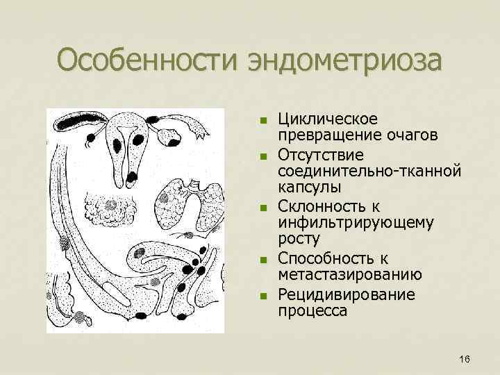 Особенности эндометриоза n n n Циклическое превращение очагов Отсутствие соединительно-тканной капсулы Склонность к инфильтрирующему