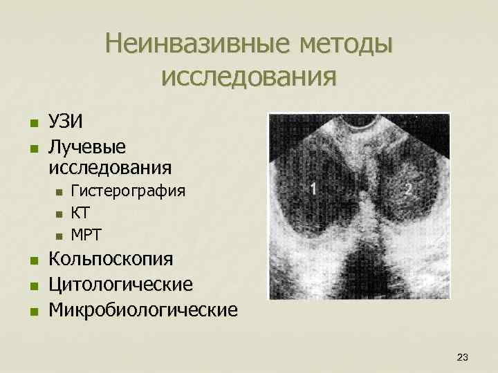 Неинвазивные методы исследования n n УЗИ Лучевые исследования n n n Гистерография КТ МРТ