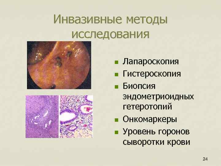 Инвазивные методы исследования n n n Лапароскопия Гистероскопия Биопсия эндометриоидных гетеротопий Онкомаркеры Уровень горонов