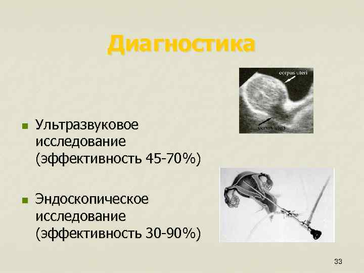 Диагностика n n Ультразвуковое исследование (эффективность 45 -70%) Эндоскопическое исследование (эффективность 30 -90%) 33