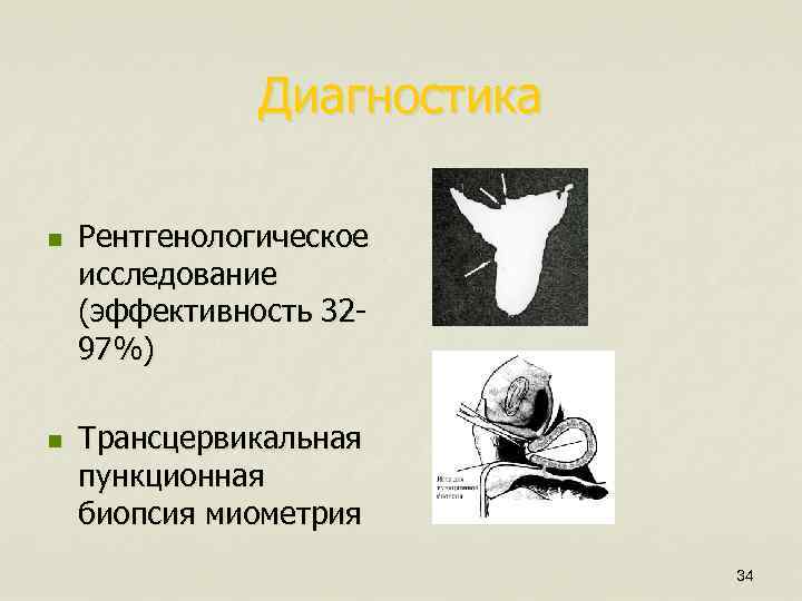 Диагностика n n Рентгенологическое исследование (эффективность 3297%) Трансцервикальная пункционная биопсия миометрия 34 