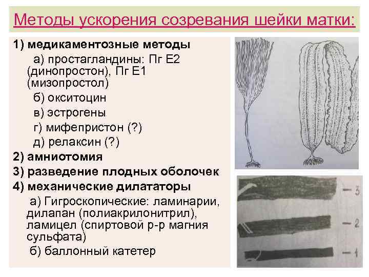 Методы ускорения созревания шейки матки: 1) медикаментозные методы а) простагландины: Пг Е 2 (динопростон),