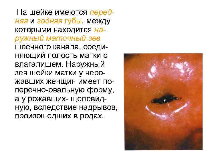 На шейке имеются передняя и задняя губы, между которыми находится наружный маточный зев шеечного